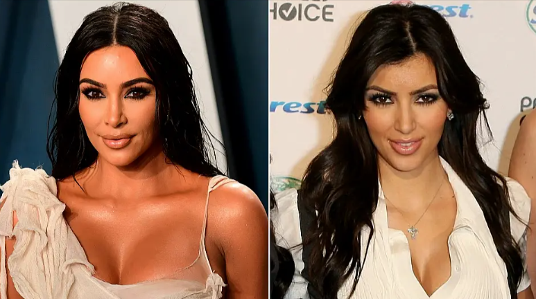 Kim Kardashian Before and After Plastic Surgery Journey